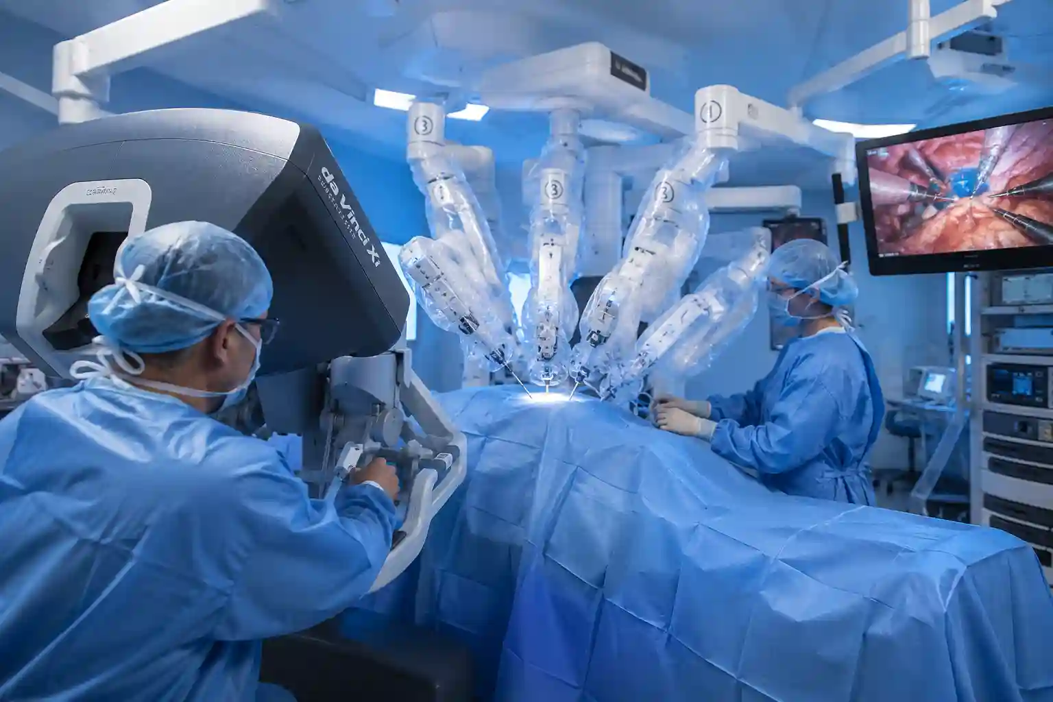 Robotic Cystectomy